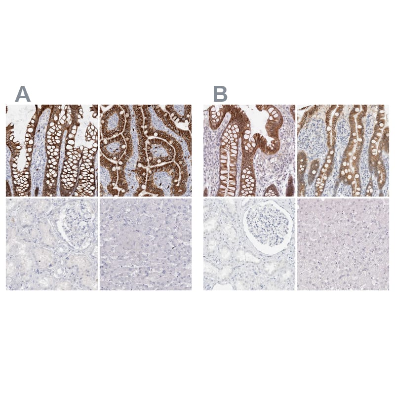 Cadherin-17 Antibody Immunohistochemistry-Paraffin: Cadherin-17 Antibody Antibody [NBP1-88237]