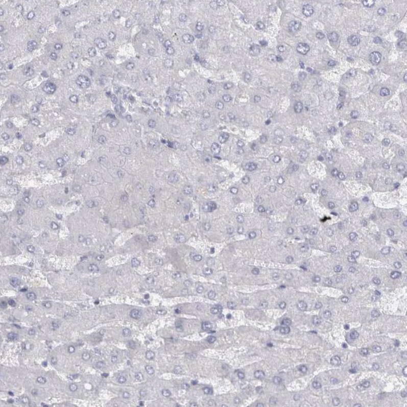 Cadherin-17 Antibody - BSA Free Immunohistochemistry-Paraffin: Cadherin-17 Antibody - BSA Free [NBP1-88237]