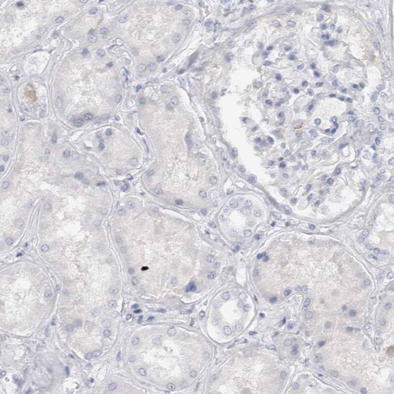Cadherin-17 Antibody - BSA Free Immunohistochemistry-Paraffin: Cadherin-17 Antibody - BSA Free [NBP1-88237]