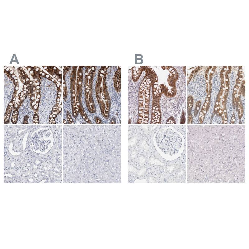 Cadherin-17 Antibody Immunohistochemistry-Paraffin: Cadherin-17 Antibody Antibody [NBP1-88238]