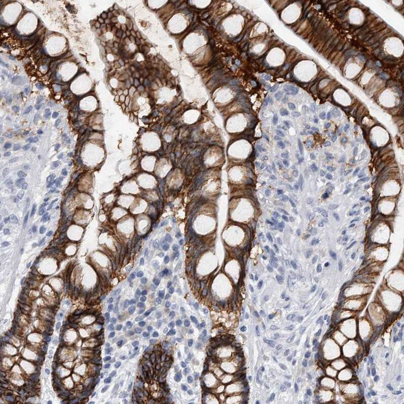 Cadherin-17 Antibody - BSA Free Immunohistochemistry-Paraffin: Cadherin-17 Antibody - BSA Free [NBP1-88238]