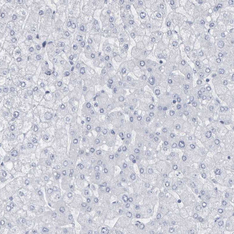 Cadherin-17 Antibody - BSA Free Immunohistochemistry-Paraffin: Cadherin-17 Antibody - BSA Free [NBP1-88238]