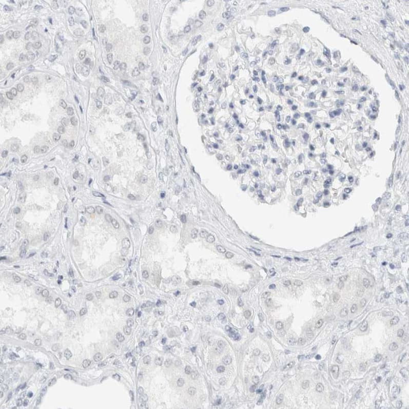 Cadherin-17 Antibody - BSA Free Immunohistochemistry-Paraffin: Cadherin-17 Antibody - BSA Free [NBP1-88239]