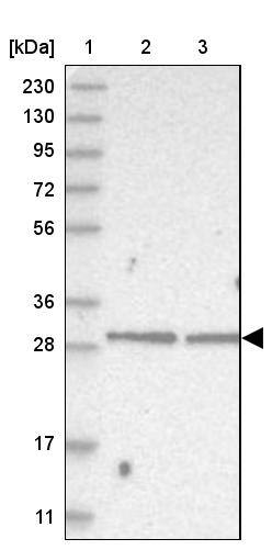 CGI 62 Antibody - BSA Free Western Blot: CGI 62 Antibody - BSA Free [NBP1-88246]