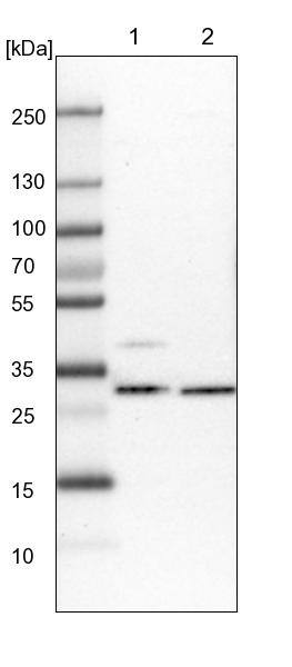 CGI 62 Antibody - BSA Free Western Blot: CGI 62 Antibody - BSA Free [NBP1-88246]