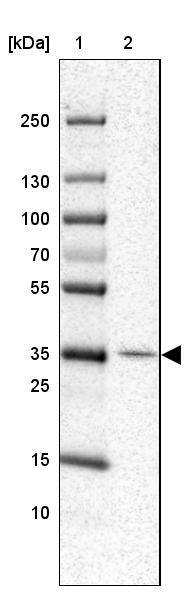 IBRDC1 Antibody - BSA Free Western Blot: IBRDC1 Antibody - BSA Free [NBP1-88253]