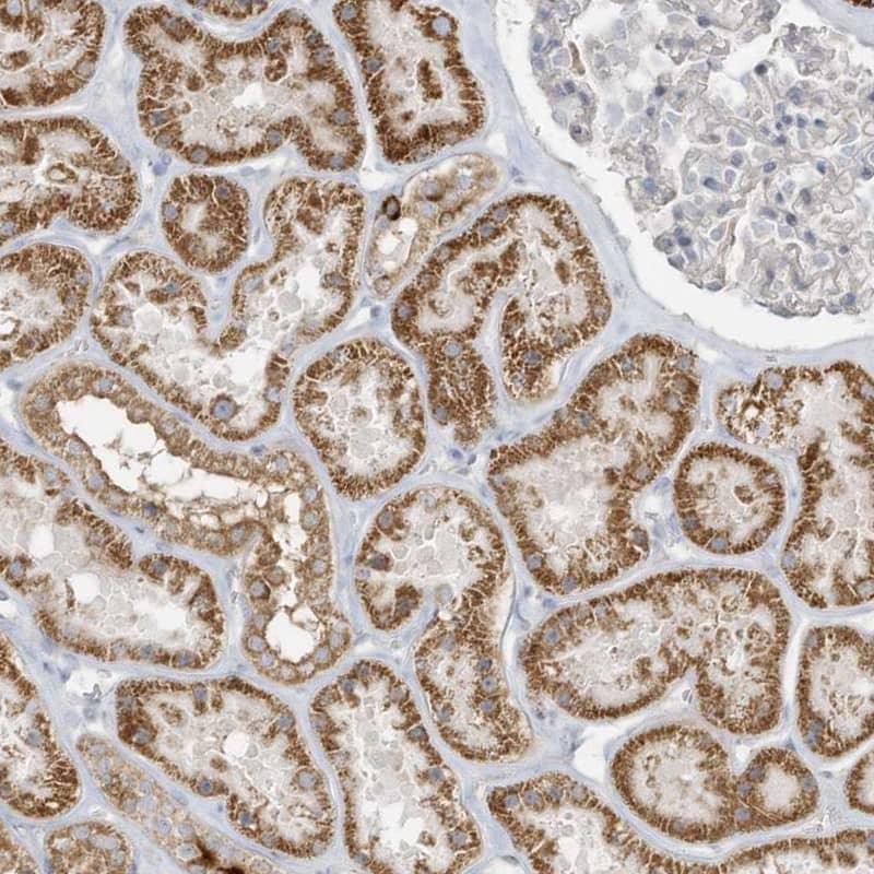 ICBP90 Binding Protein 1 Antibody - BSA Free Immunohistochemistry-Paraffin: ICBP90 Binding Protein 1 Antibody - BSA Free [NBP1-88254]
