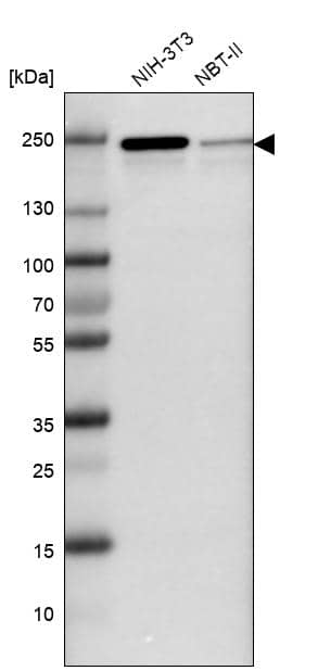 JMJD1B Antibody - BSA Free Western Blot: JMJD1B Antibody - BSA Free [NBP1-88256]