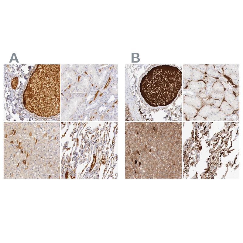 C4 binding protein A Antibody - BSA Free Immunohistochemistry-Paraffin: C4 binding protein A Antibody - BSA Free [NBP1-88262]