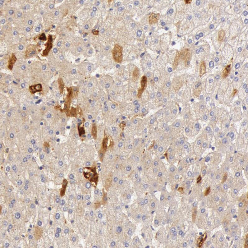 C4 binding protein A Antibody - BSA Free Immunohistochemistry-Paraffin: C4 binding protein A Antibody - BSA Free [NBP1-88262]