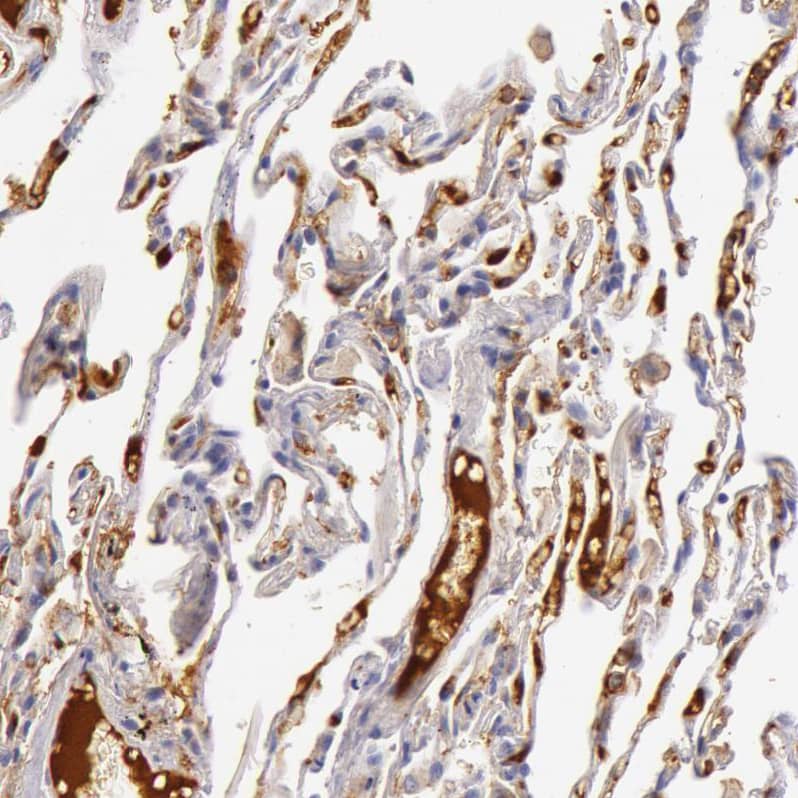 C4 binding protein A Antibody - BSA Free Immunohistochemistry-Paraffin: C4 binding protein A Antibody - BSA Free [NBP1-88262]