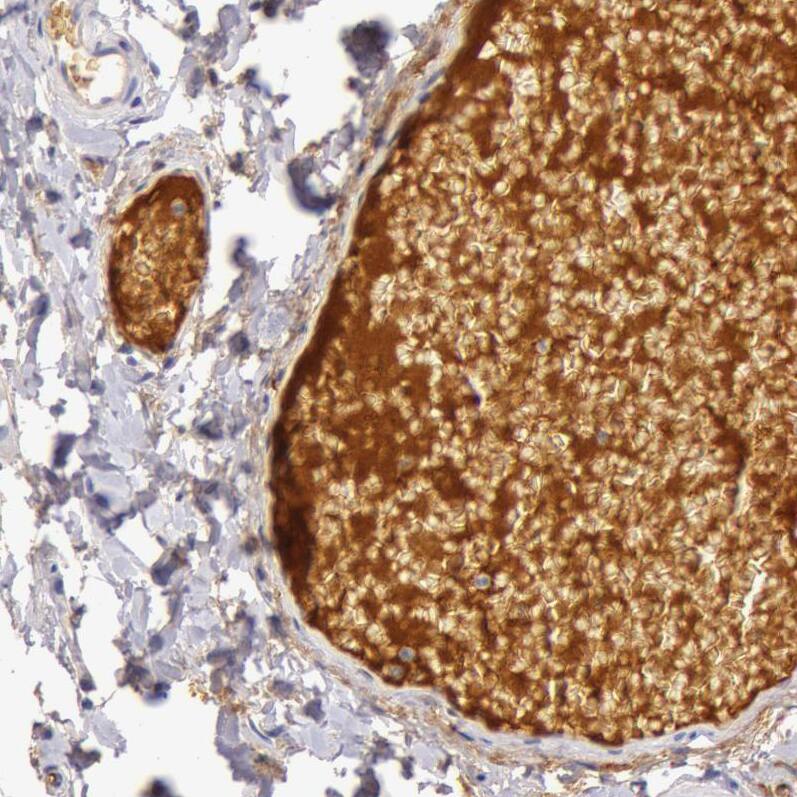 C4 binding protein A Antibody - BSA Free Immunohistochemistry-Paraffin: C4 binding protein A Antibody - BSA Free [NBP1-88262]