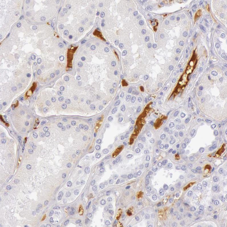C4 binding protein A Antibody - BSA Free Immunohistochemistry-Paraffin: C4 binding protein A Antibody - BSA Free [NBP1-88262]