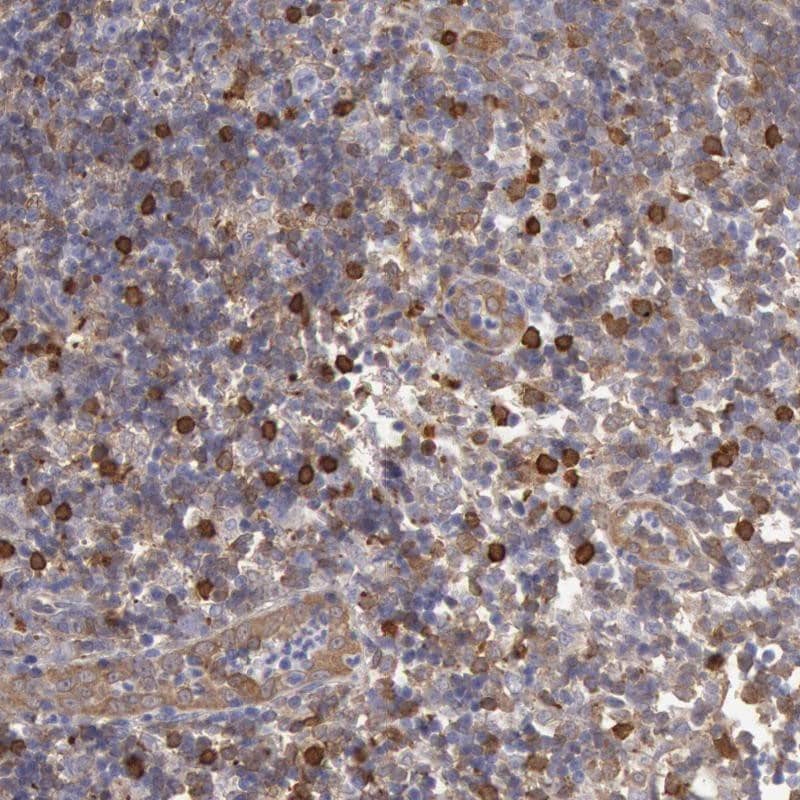 Ymer Antibody - BSA Free Immunohistochemistry-Paraffin: Ymer Antibody [NBP1-88265]