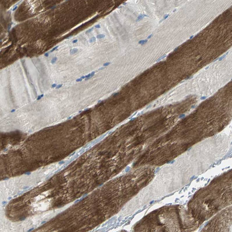 GRF2 Antibody - BSA Free Immunohistochemistry-Paraffin: GRF2 Antibody - BSA Free [NBP1-88266]