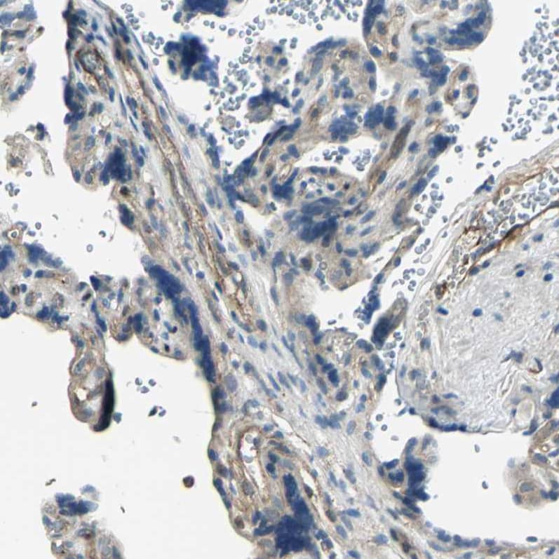 GRF2 Antibody - BSA Free Immunohistochemistry-Paraffin: GRF2 Antibody - BSA Free [NBP1-88266]