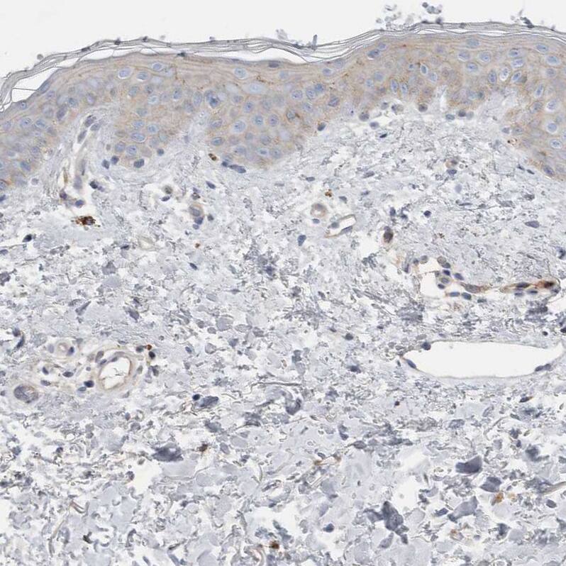 Complement Factor I Antibody Immunohistochemistry-Paraffin: Complement Factor I Antibody [NBP1-88267]