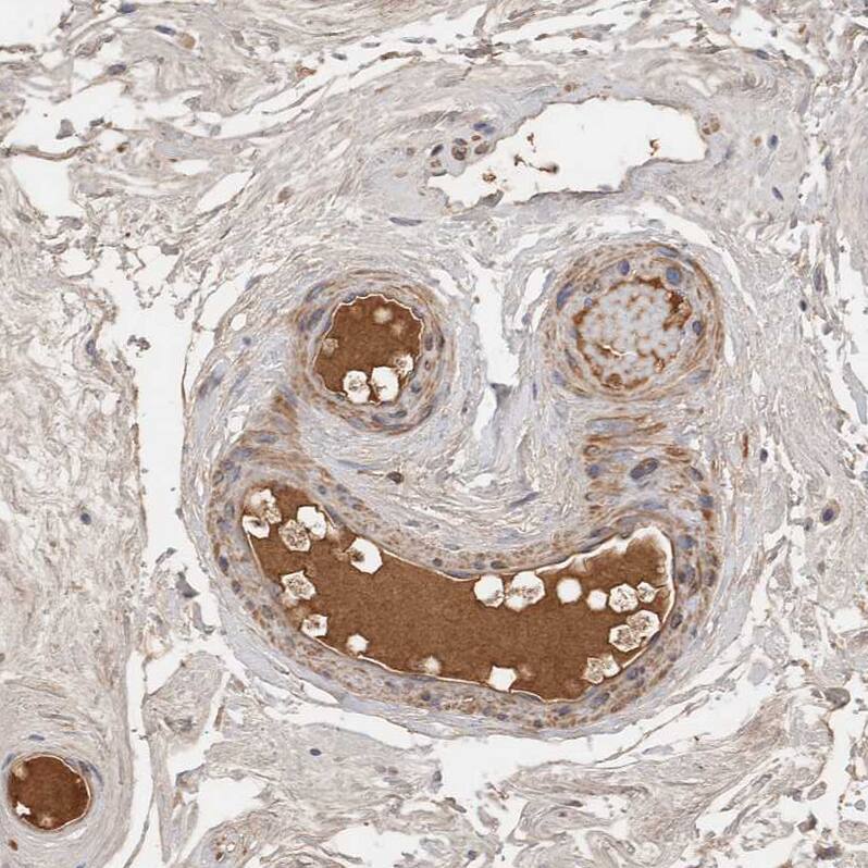 Complement Factor I Antibody Immunohistochemistry-Paraffin: Complement Factor I Antibody [NBP1-88267]