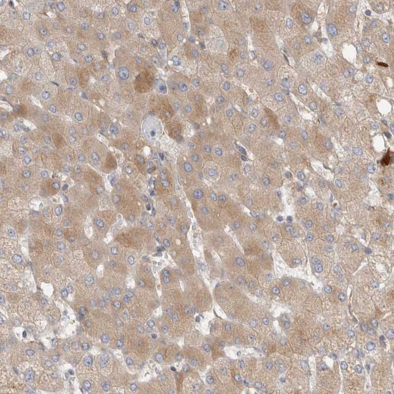 Complement Factor I Antibody Immunohistochemistry-Paraffin: Complement Factor I Antibody [NBP1-88267]