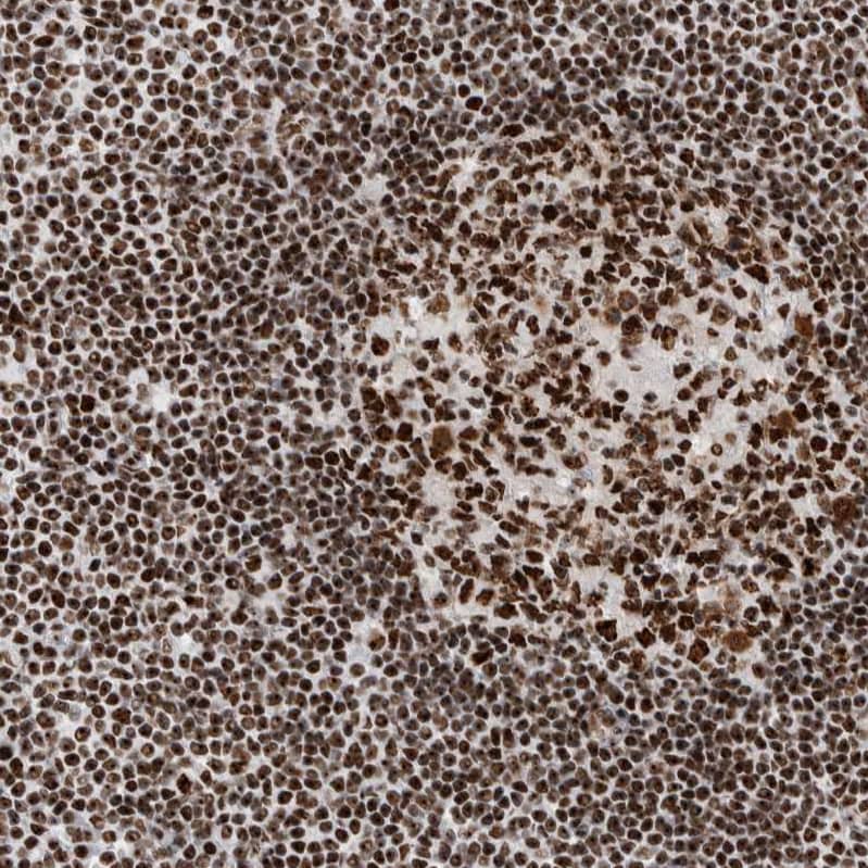 Nucleolin Antibody - BSA Free Immunohistochemistry-Paraffin: Nucleolin Antibody - BSA Free [NBP1-88271]