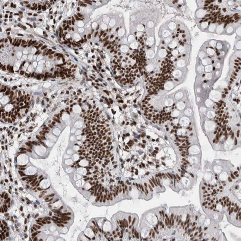 Nucleolin Antibody - BSA Free Immunohistochemistry-Paraffin: Nucleolin Antibody - BSA Free [NBP1-88271]