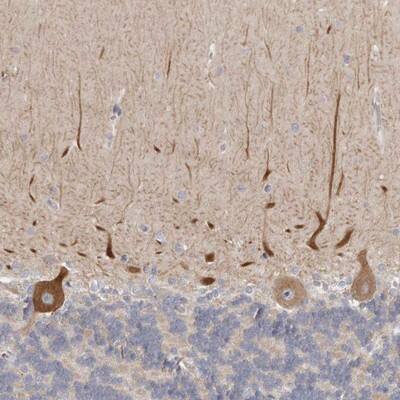 C21orf59 Antibody - BSA Free Immunohistochemistry-Paraffin: C21orf59 Antibody - BSA Free [NBP1-88275]