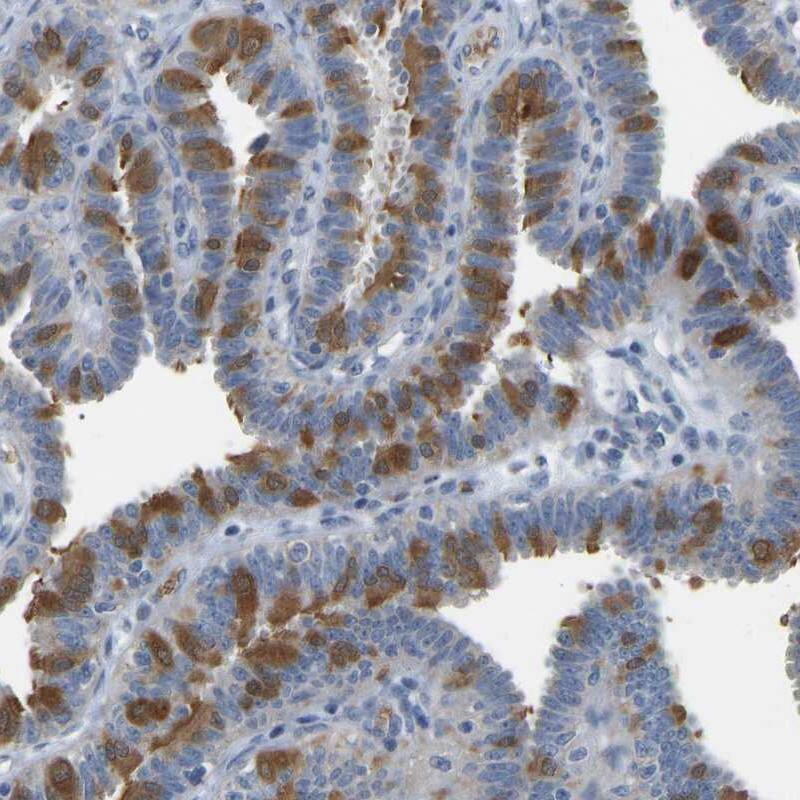C21orf59 Antibody - BSA Free Immunohistochemistry-Paraffin: C21orf59 Antibody - BSA Free [NBP1-88276]