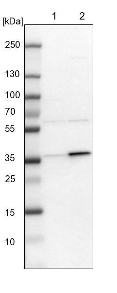 C21orf59 Antibody - BSA Free Western Blot: C21orf59 Antibody - BSA Free [NBP1-88277]