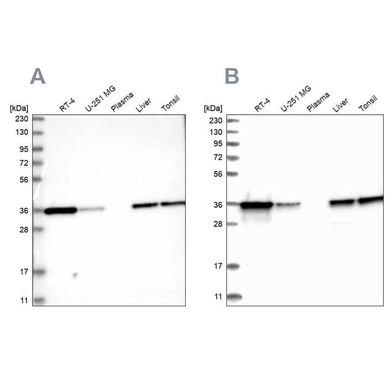 Pyridoxal Kinase/PDXK Antibody - BSA Free Western Blot: Pyridoxal Kinase/PDXK Antibody - BSA Free [NBP1-88283]