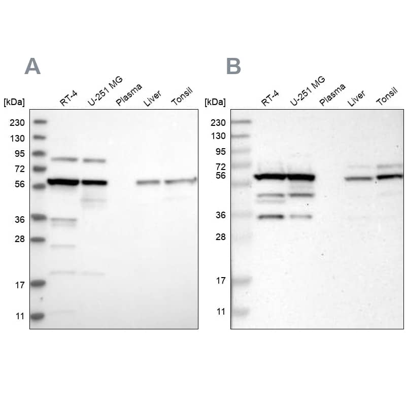 CCT8 Antibody - BSA Free Western Blot: CCT8 Antibody - BSA Free [NBP1-88285]