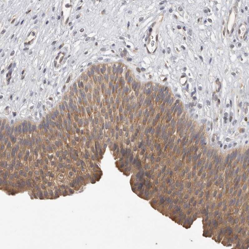CCT8 Antibody - BSA Free Immunohistochemistry-Paraffin: CCT8 Antibody - BSA Free [NBP1-88285]