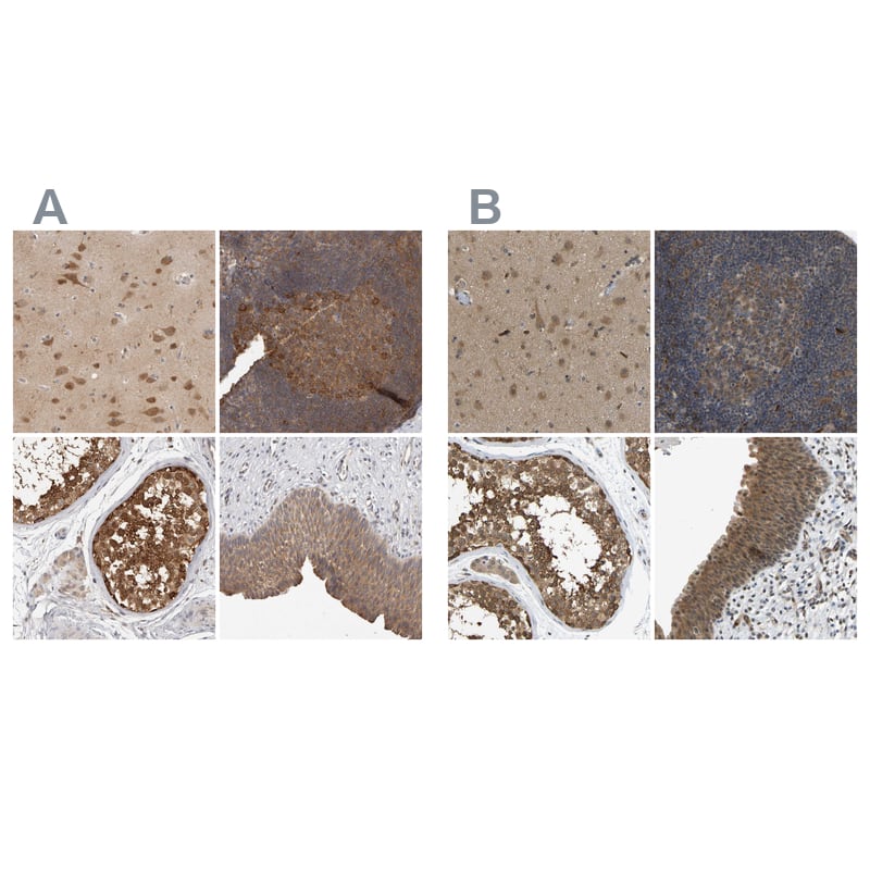 CCT8 Antibody - BSA Free Immunohistochemistry-Paraffin: CCT8 Antibody - BSA Free [NBP1-88285]
