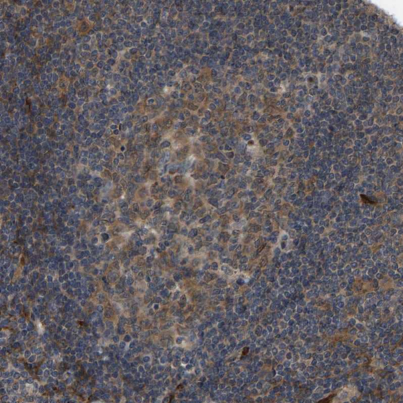CCT8 Antibody - BSA Free Immunohistochemistry-Paraffin: CCT8 Antibody - BSA Free [NBP1-88287]
