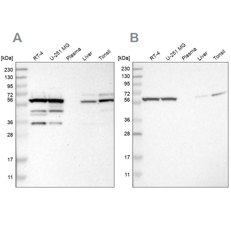 CCT8 Antibody - BSA Free Western Blot: CCT8 Antibody - BSA Free [NBP1-88287]