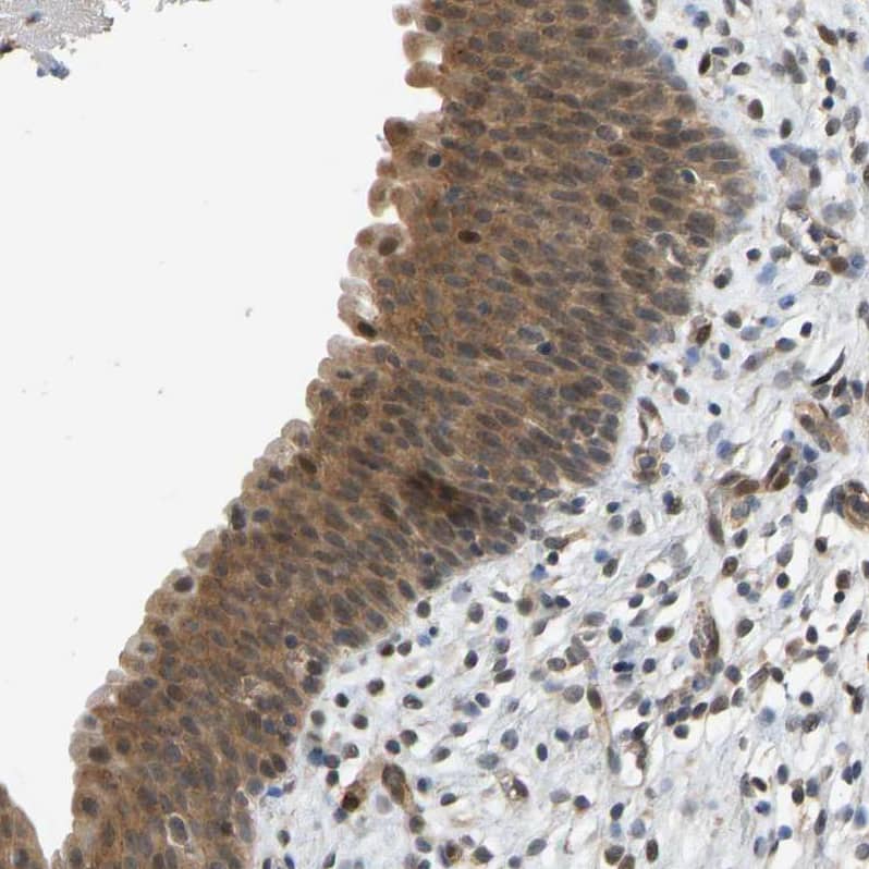 CCT8 Antibody - BSA Free Immunohistochemistry-Paraffin: CCT8 Antibody - BSA Free [NBP1-88287]