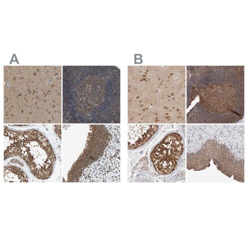 CCT8 Antibody - BSA Free Immunohistochemistry-Paraffin: CCT8 Antibody - BSA Free [NBP1-88287]