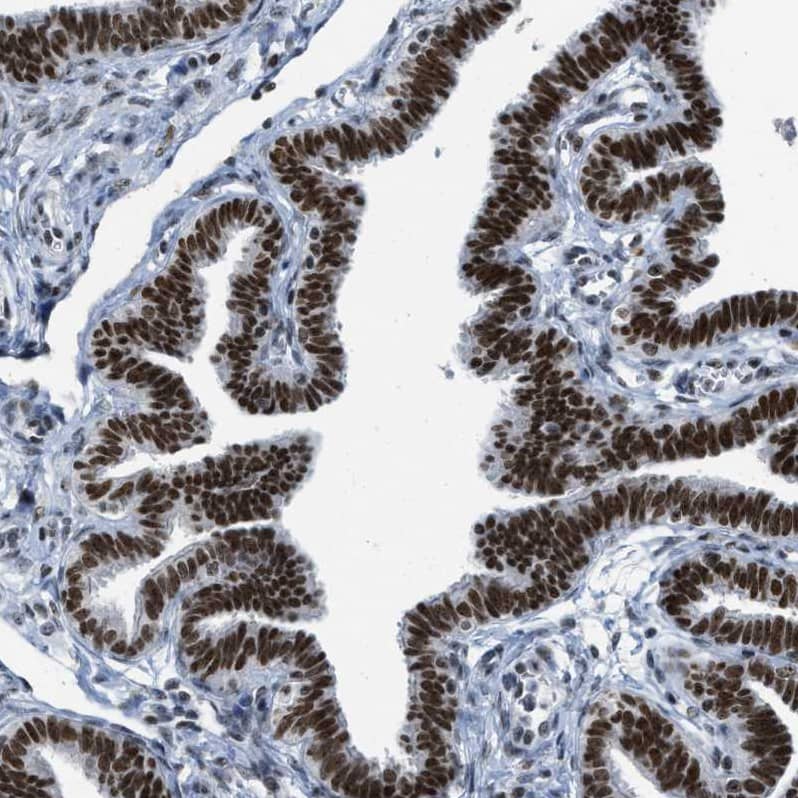 URB1 Antibody - BSA Free Immunohistochemistry-Paraffin: URB1 Antibody - BSA Free [NBP1-88288]