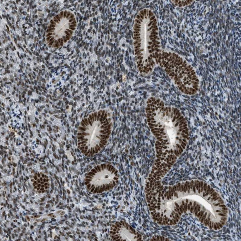 URB1 Antibody - BSA Free Immunohistochemistry-Paraffin: URB1 Antibody - BSA Free [NBP1-88288]