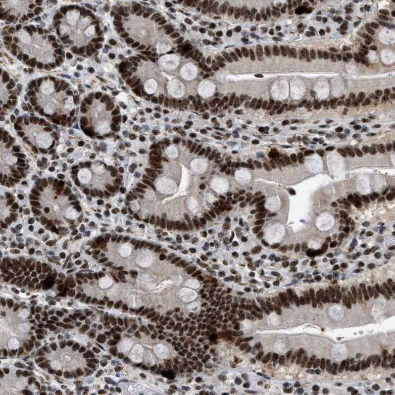 URB1 Antibody - BSA Free Immunohistochemistry-Paraffin: URB1 Antibody - BSA Free [NBP1-88288]