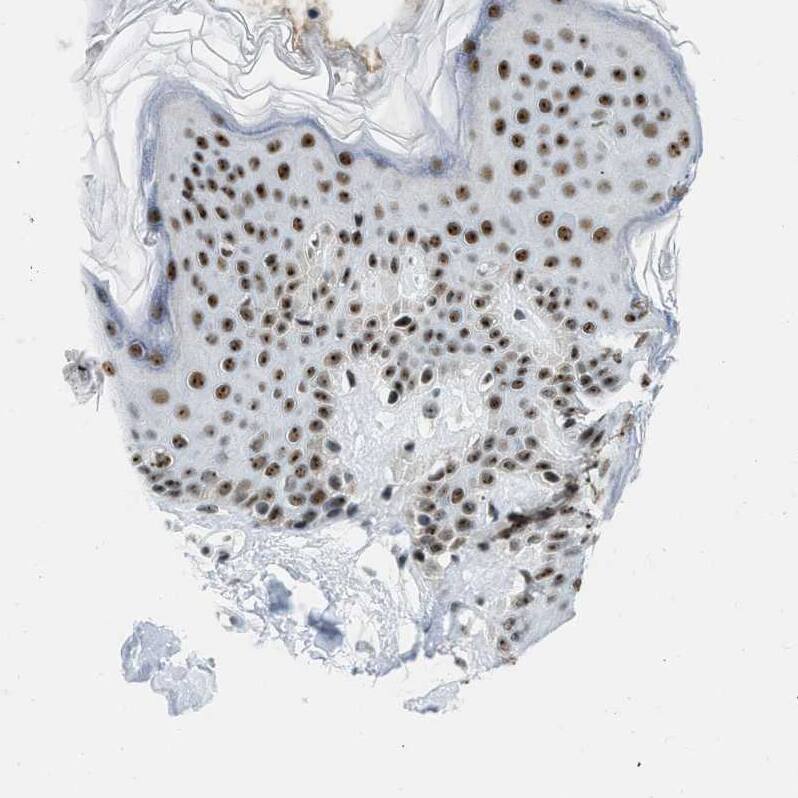 URB1 Antibody - BSA Free Immunohistochemistry-Paraffin: URB1 Antibody - BSA Free [NBP1-88288]
