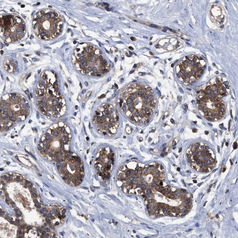 LRRC3 Antibody - BSA Free Immunohistochemistry-Paraffin: LRRC3 Antibody [NBP1-88289]