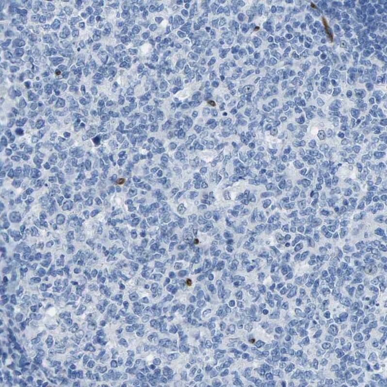 HspA12B Antibody - BSA Free Immunohistochemistry-Paraffin: HspA12B Antibody - BSA Free [NBP1-88293]
