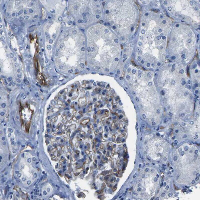 HspA12B Antibody - BSA Free Immunohistochemistry-Paraffin: HspA12B Antibody - BSA Free [NBP1-88293]