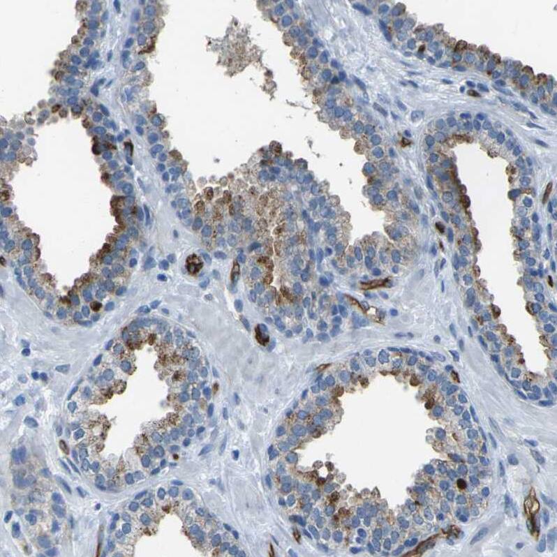 HspA12B Antibody - BSA Free Immunohistochemistry-Paraffin: HspA12B Antibody - BSA Free [NBP1-88293]