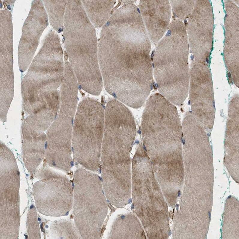 HspA12B Antibody - BSA Free Immunohistochemistry-Paraffin: HspA12B Antibody - BSA Free [NBP1-88294]