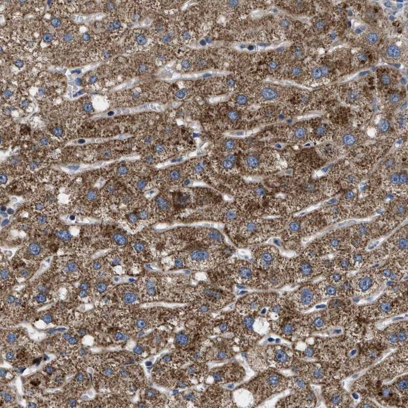 HspA12B Antibody - BSA Free Immunohistochemistry-Paraffin: HspA12B Antibody - BSA Free [NBP1-88294]