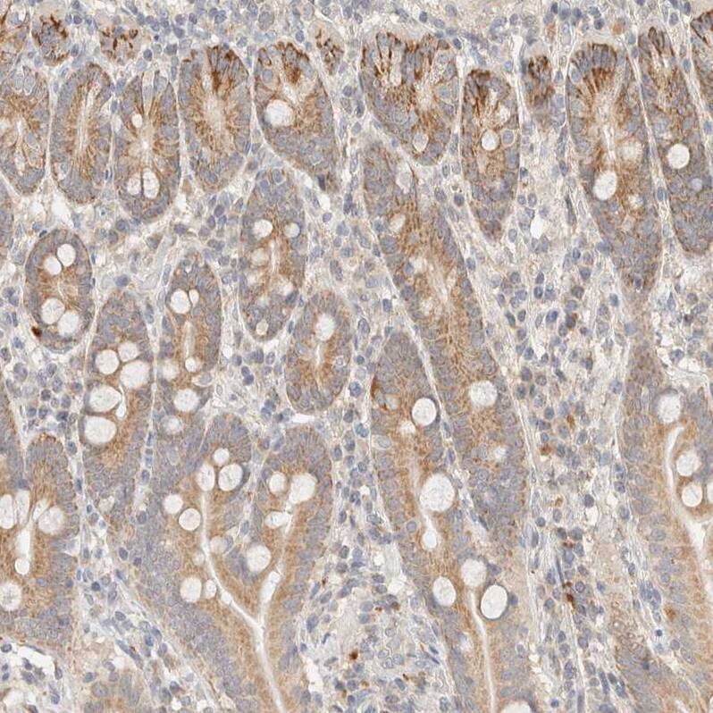 ITPA Antibody - BSA Free Immunohistochemistry-Paraffin: ITPA Antibody - BSA Free [NBP1-88296]