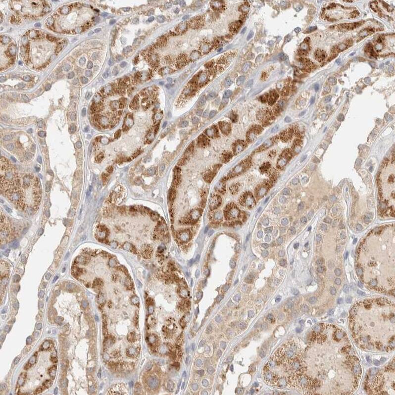 ITPA Antibody - BSA Free Immunohistochemistry-Paraffin: ITPA Antibody - BSA Free [NBP1-88296]