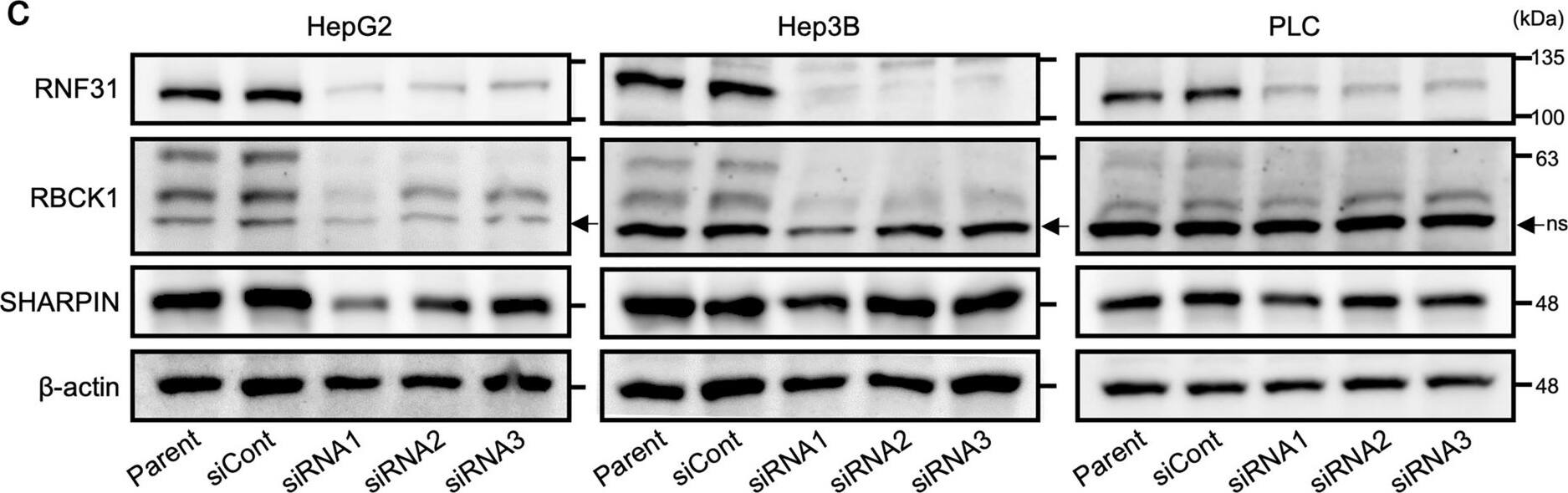 RBCK1 Antibody - BSA Free