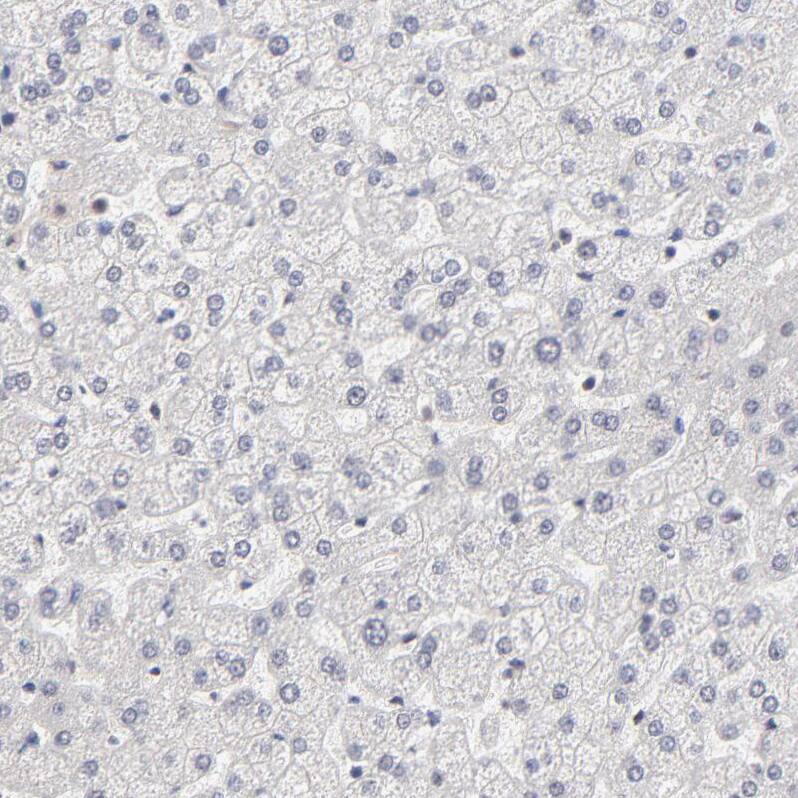 DSN1 Antibody - BSA Free Immunohistochemistry-Paraffin: DSN1 Antibody - BSA Free [NBP1-88302]
